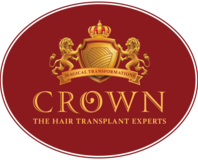Crown Hair Transplant Experts
